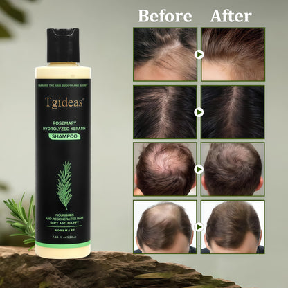 Tgideas Rosemary ShampooHairGrowth & Anti-Dandruff
