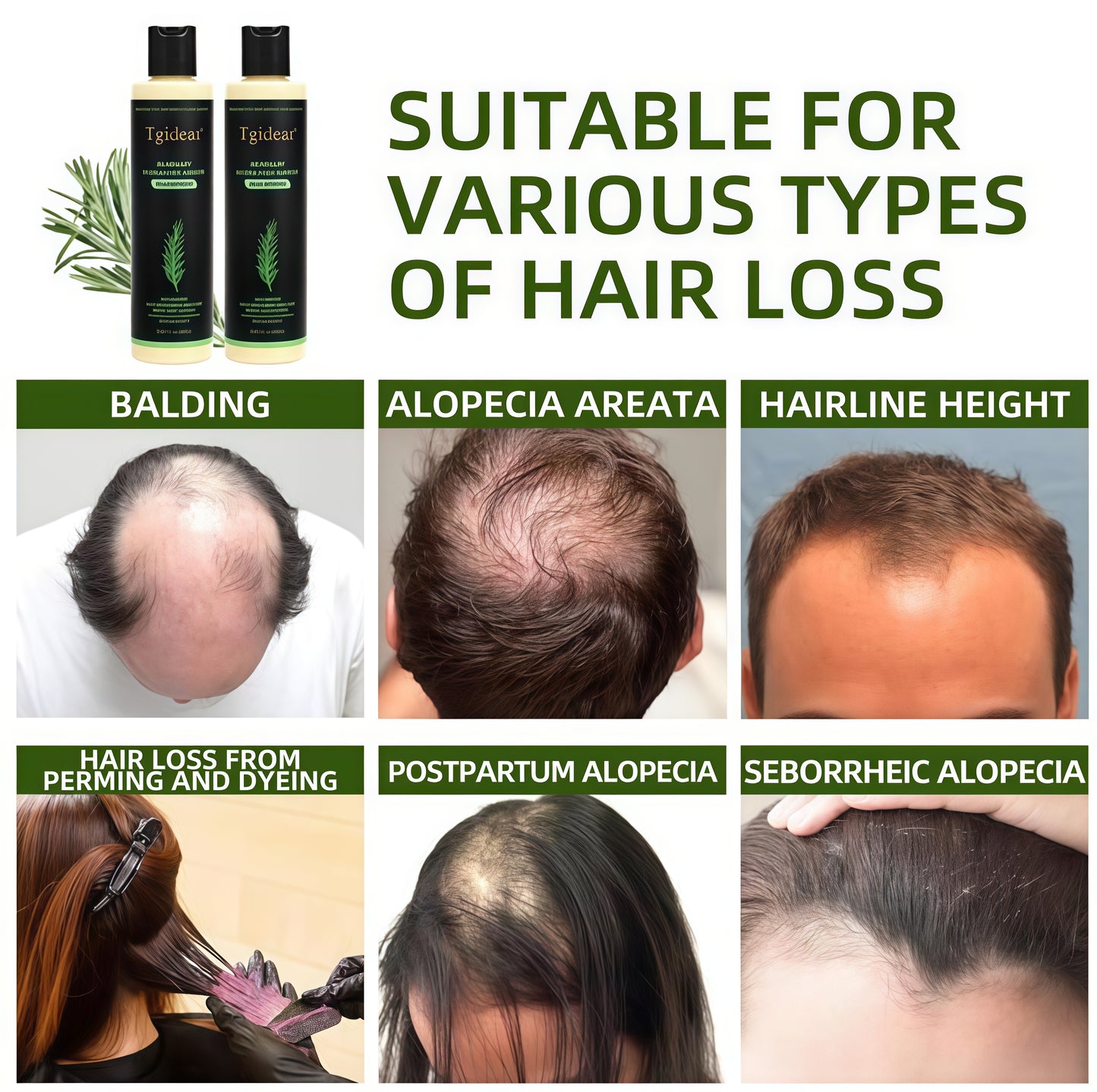 Tgideas Rosemary ShampooHairGrowth & Anti-Dandruff